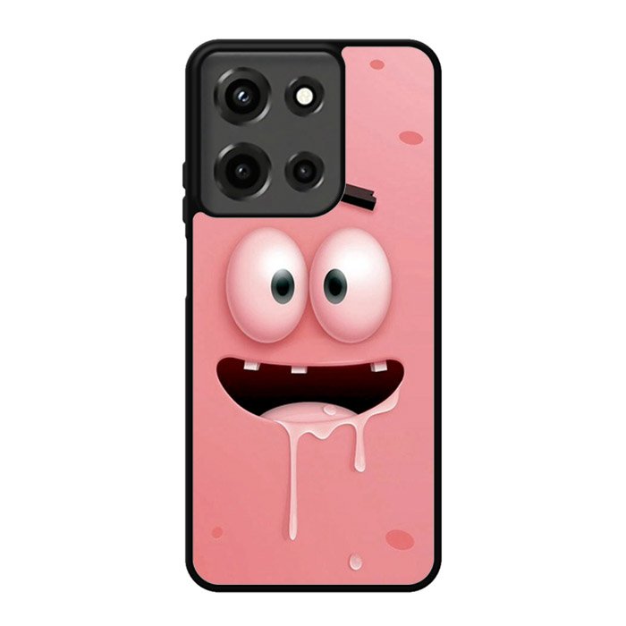 patrick star face Z0840 Motorola Moto G 5G 2025 Case